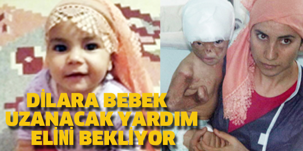 DİLARA BEBEK UZANACAK YARDIM ELİNİ BEKLİYOR