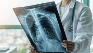 Kronik Hastalar COVİD-19 Aşısı Bekliyor