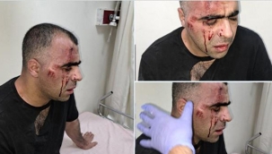 Gazeteci Aygül, Belediye Başkanı'nın Korumalarının Saldırısına Uğradı