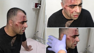 Gazeteci Sinan Aygül'ü Darp Eden Korumalar Tutuklandı